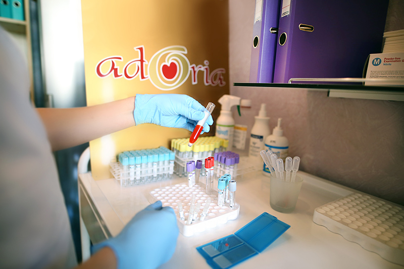 SIA „Centrālā laboratorija” piedāvā laboratorijas pakalpojumus!