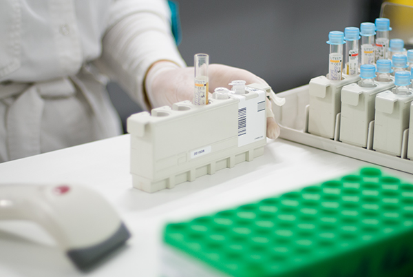 Urīna analīze - garām skrienot, nesanāks!